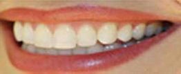 Clínica Dental David Romero dientes y labios