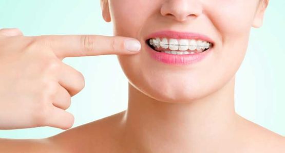 Clínica Dental David Romero dientes blancos