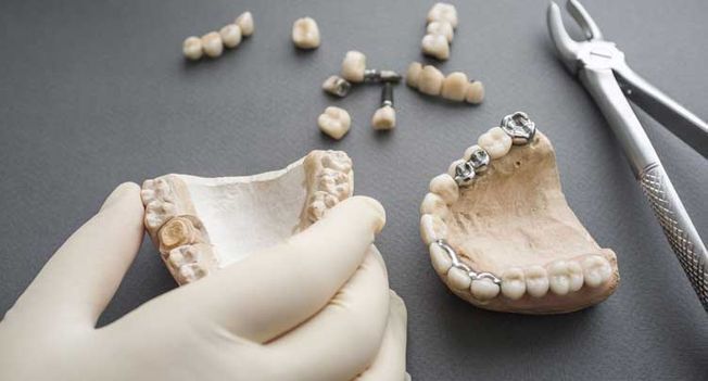 Clínica Dental David Romero implantes